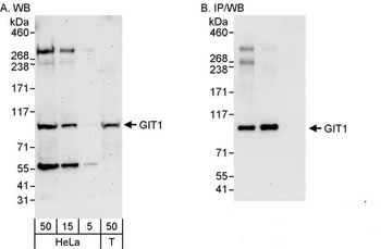 Rabbit anti-GIT1 Antibody