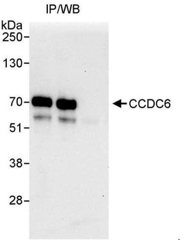 Rabbit anti-CCDC6 Antibody