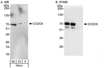 Rabbit anti-CCDC6 Antibody