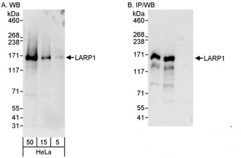 Rabbit anti-LARP1 Antibody