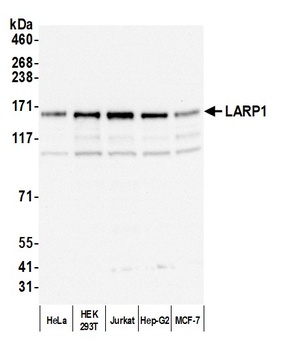 LARP1 Antibody