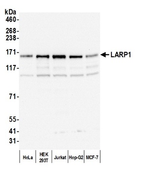 Rabbit anti-LARP1 Antibody