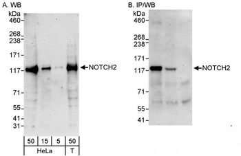 Rabbit anti-Notch2 Antibody