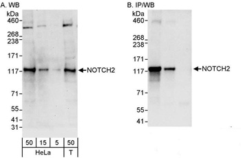 Rabbit anti-Notch2 Antibody