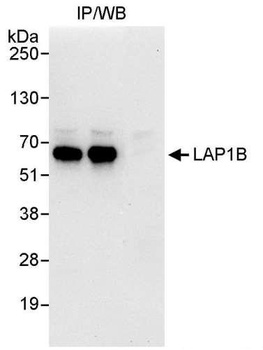 LAP1B Antibody