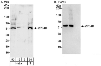 VPS4B Antibody