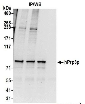 hPrp3p Antibody