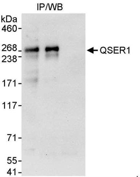 QSER1 Antibody