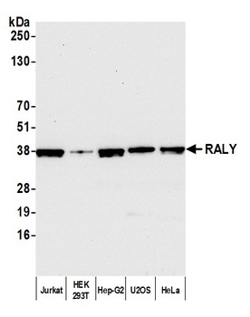 Rabbit anti-RALY Antibody
