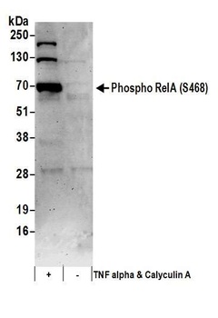 RelA, Phospho (S468) Antibody