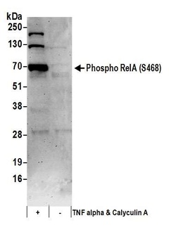 Rabbit anti-Phospho RelA (S468) Antibody