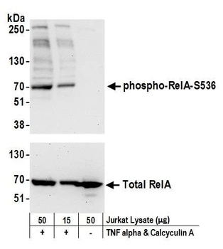 RelA, Phospho (S536) Antibody