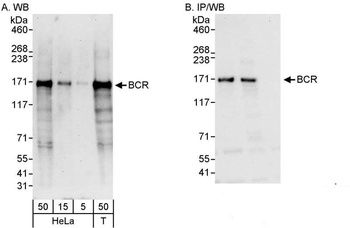 Rabbit anti-BCR Antibody