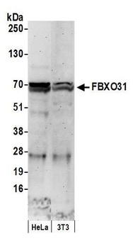 FBXO31 Antibody