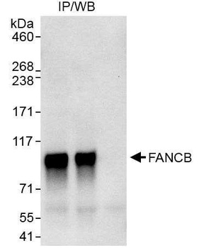 FANCB Antibody