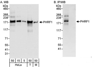 Rabbit anti-PHRF1 Antibody