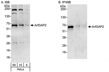 Rabbit anti-ArfGAP2 Antibody