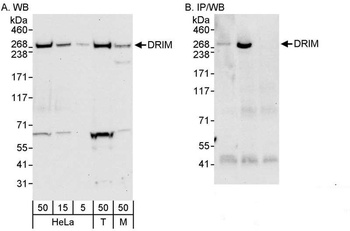 Rabbit anti-DRIM Antibody