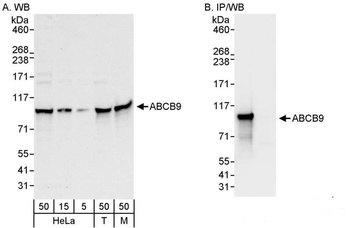 ABCB9 Antibody