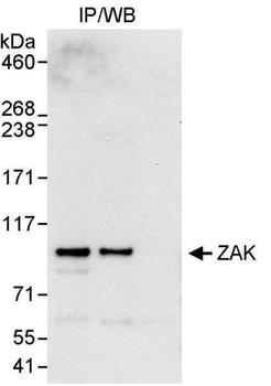 ZAK Antibody