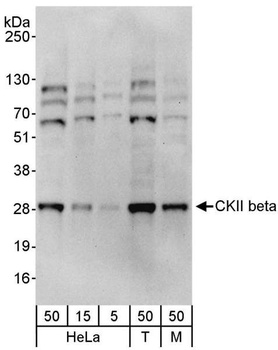 CKII beta Antibody