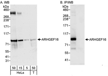 Rabbit anti-ARHGEF16 Antibody
