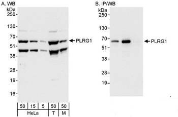 Rabbit anti-PLRG1 Antibody