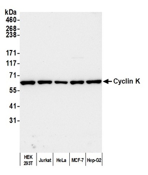 Rabbit anti-Cyclin K Antibody
