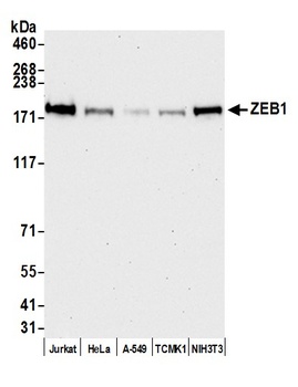 ZEB1 Antibody