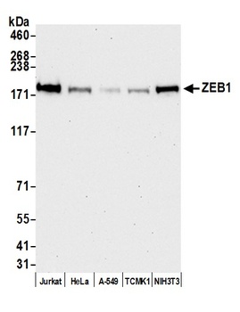 Rabbit anti-ZEB1 Antibody