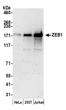 ZEB1 Antibody