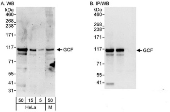 Rabbit anti-GCF Antibody