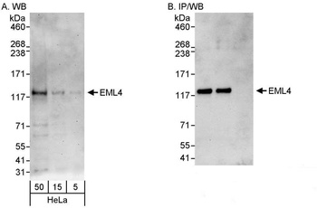 Rabbit anti-EML4 Antibody