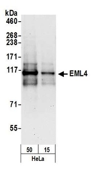 EML4 Antibody