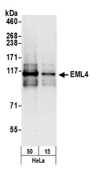 Rabbit anti-EML4 Antibody