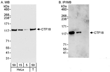 Rabbit anti-CTF18 Antibody