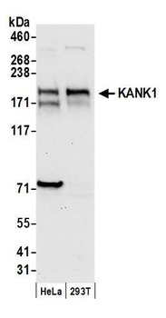 KANK1 Antibody
