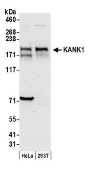 Rabbit anti-KANK1 Antibody
