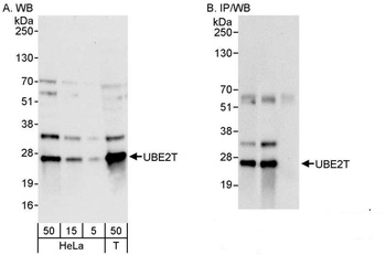 Rabbit anti-UBE2T Antibody