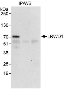 LRWD1 Antibody