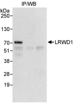 Rabbit anti-LRWD1 Antibody