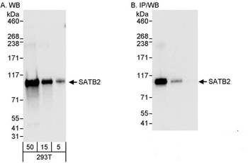 Rabbit anti-SATB2 Antibody