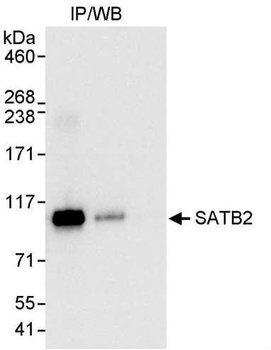 Rabbit anti-SATB2 Antibody