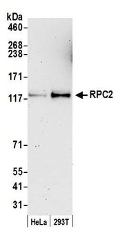 RPC2 Antibody
