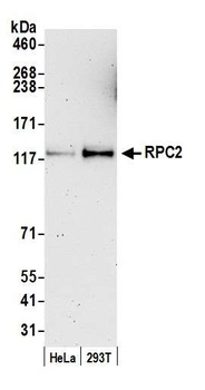 Rabbit anti-RPC2 Antibody
