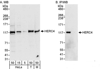 Rabbit anti-HERC4 Antibody