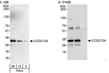 Rabbit anti-CCDC124 Antibody