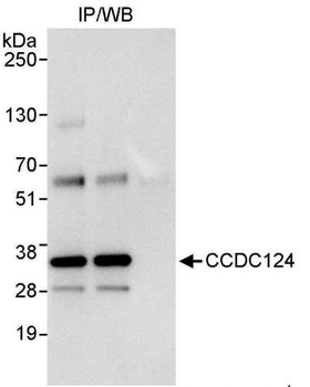 Rabbit anti-CCDC124 Antibody