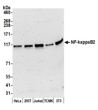 NF-kappaB2 Antibody