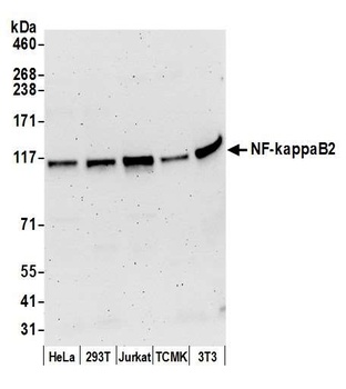 Rabbit anti-NF-kappaB2 Antibody